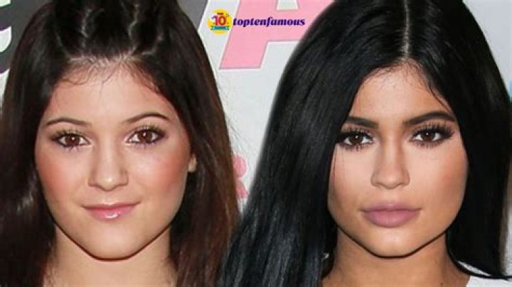 Photos Of Kylie Jenner Then Vs. Now Prove How Much She's Changed Over