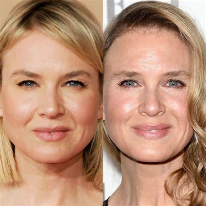 Renee Zellweger Now And Then