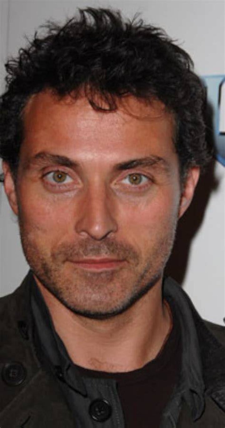 Rufus Sewell's Eye Problem Explored