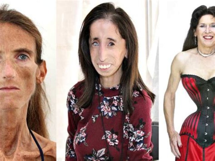 Skinniest Person Meet 10 World's Thinnest People Alive 2023 The