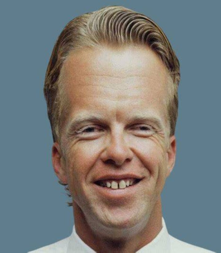 The Biggest Forehead In The World |