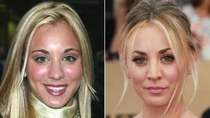 The Long List Of Celebs Who Have Gotten Nose Jobs (And What They Looked Like Before)