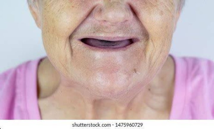 Toothless mouth. An elderly woman with no teeth. Old Granny with her