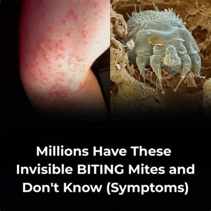 Uncover The Hidden World Of Mite Bites: Pictures Reveal Astonishing Truths