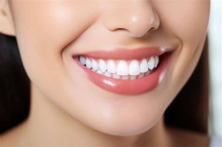 Uncovering The Secrets To A Perfect Smile