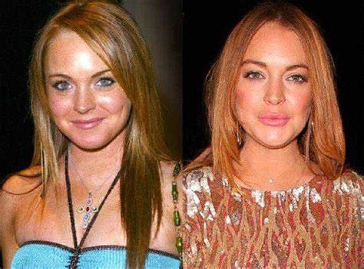 Unraveling Lindsay Lohan's Transformative Journey