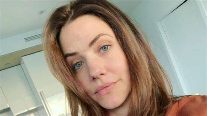 Unraveling The Enigma: Julie Gonzalo's Scar Discoveries And Insights
