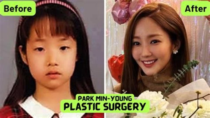 Unveiling Park Min Young's Transformation: Pre-Surgery Insights