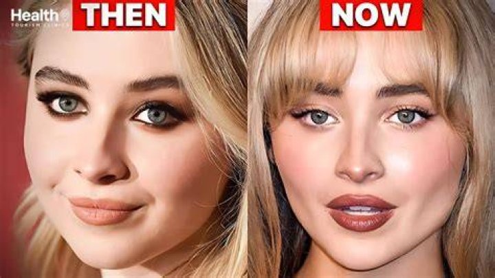 Unveiling Sabrina Carpenter's Plastic Surgery Journey