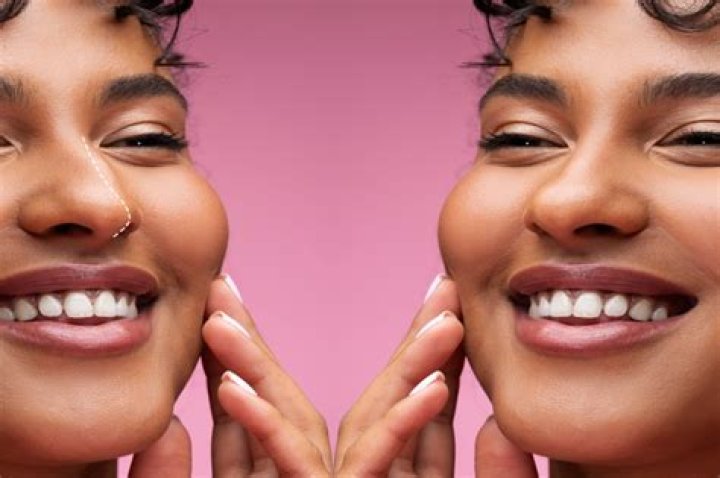 Unveiling The Journey To A Confident Grin