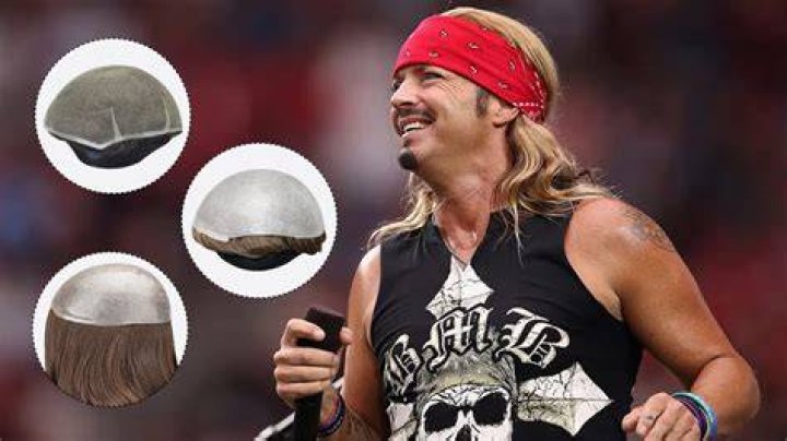 Unveiling The Secrets Behind Bret Michaels' Iconic Hairline