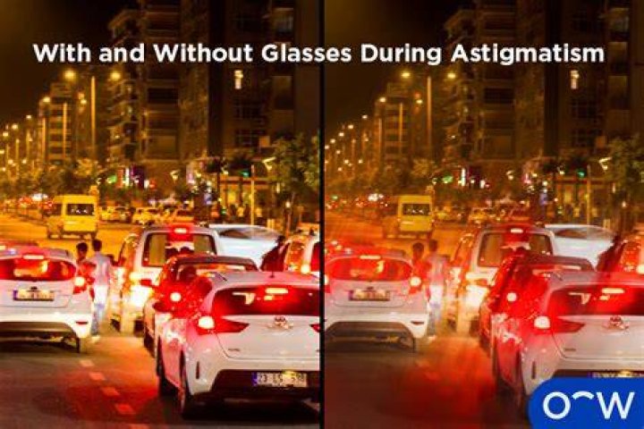 Unveiling The Secrets Of Astigmatism Lights At Night: Discoveries And Insights