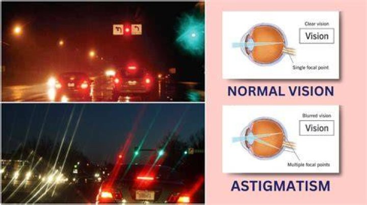 Unveiling The Secrets Of Nighttime Driving With Astigmatism