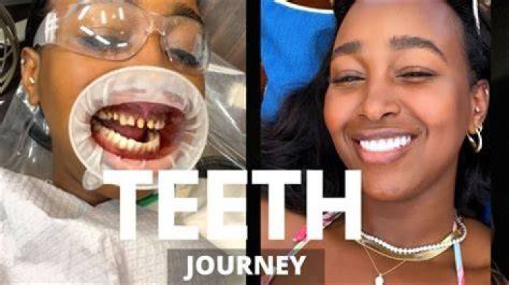 Unveiling The Truth Behind Famous Bad Teeth: Surprising Discoveries And Insights