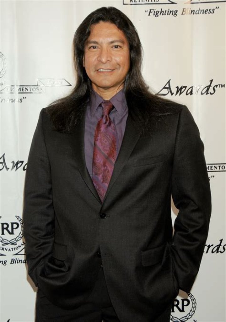 Unveiling The Truth Behind Gil Birmingham's Eye Surgery: A Visionary Journey