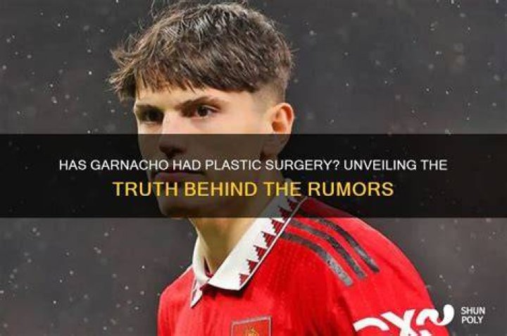 Unveiling The Truth: Has Garnacho Reshaped His Features?