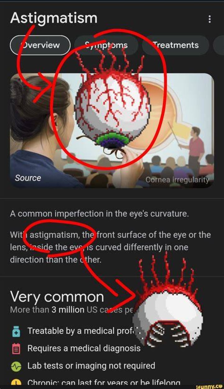 Unveiling The Wit And Wisdom Of Astigmatism Memes: Discoveries And Insights