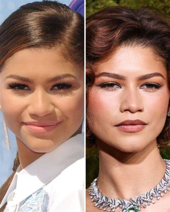 Unveiling Zendaya's Plastic Surgery Secrets: A Journey Of Discovery