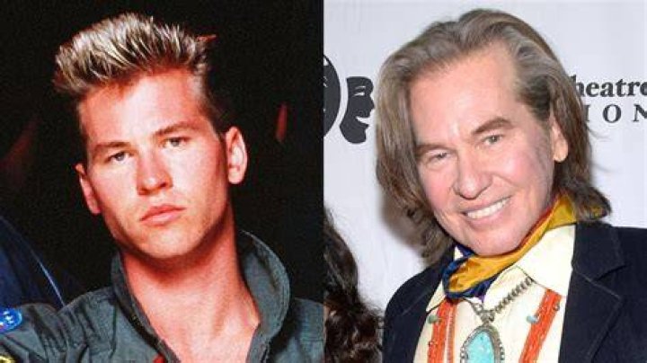 Val Kilmer's Plastic Surgery Journey