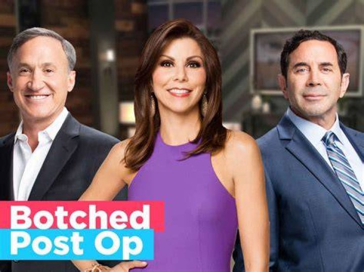 Watch Botched Post Op Online on hayu