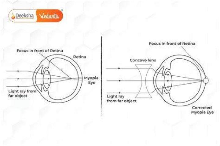 What are eye defects and their correction?