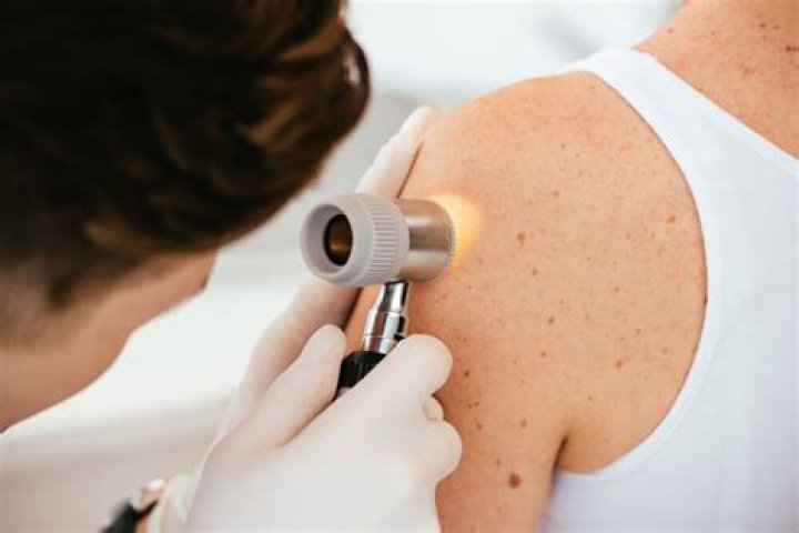What exactly does a dermatologist do?