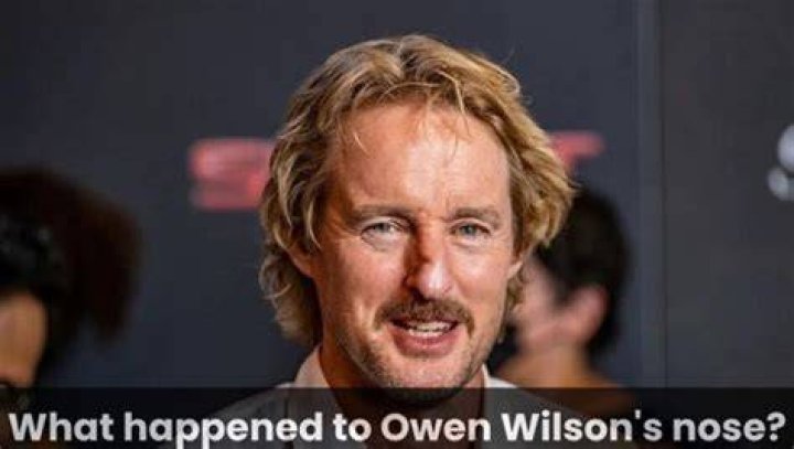 What Happened To Owen Wilson's Nose?