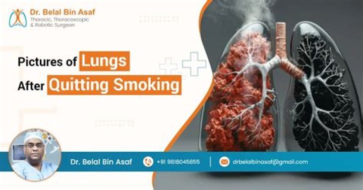 What happens if one of your lungs collapse?