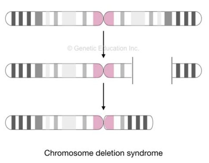 What is chromosome deletion?