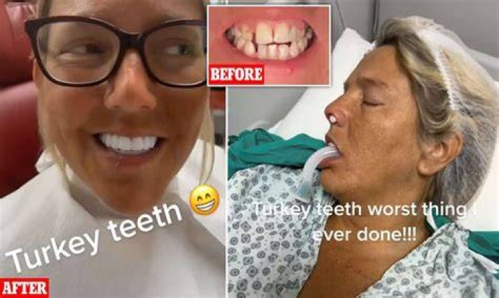 What Was Wrong With Sharyn Alfonsis Teeth?