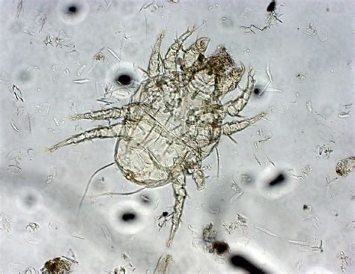 What&rsquo;s Eating You? Cheyletiella Mites MDedge Dermatology