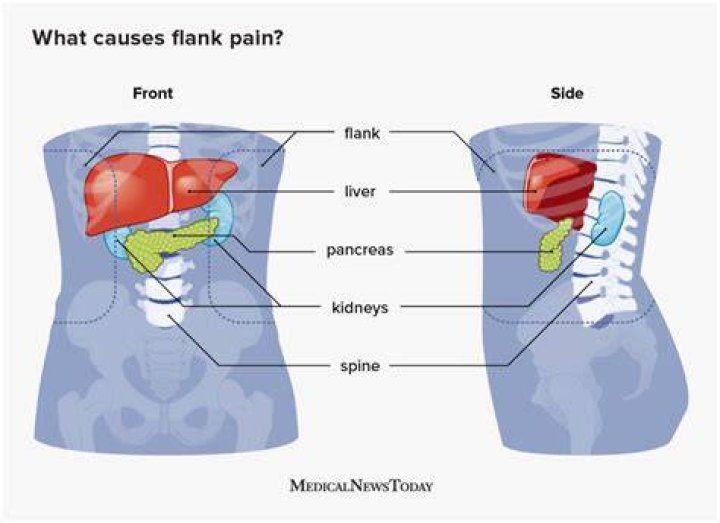 When should I worry about left flank pain?