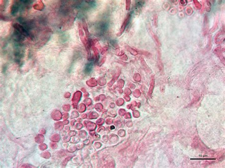 Which organism looks like spaghetti and meatballs?