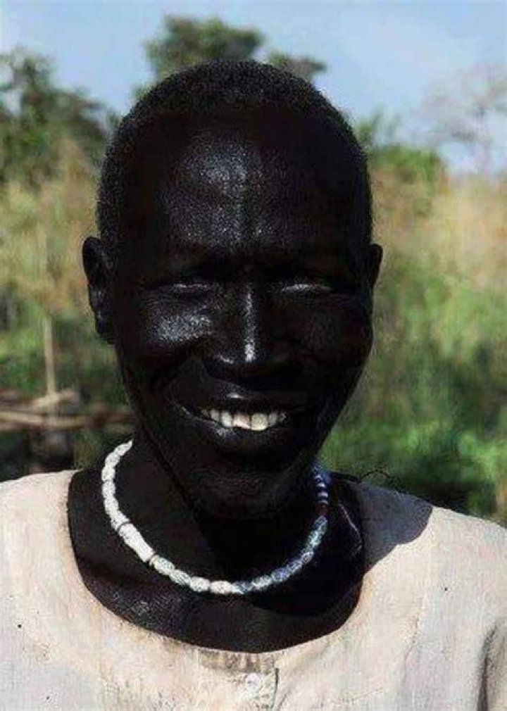Who is the Blackest Person in the World? The Truth Behind the Viral Photos |