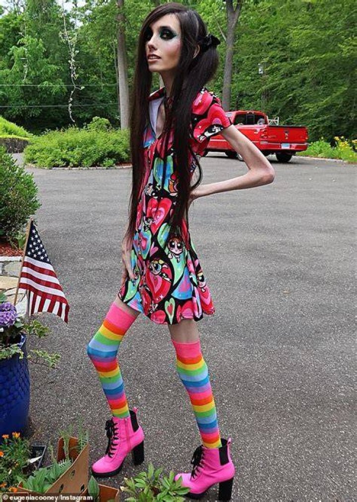 YouTuber Eugenia Cooney Leprosy Illness Disease And Health