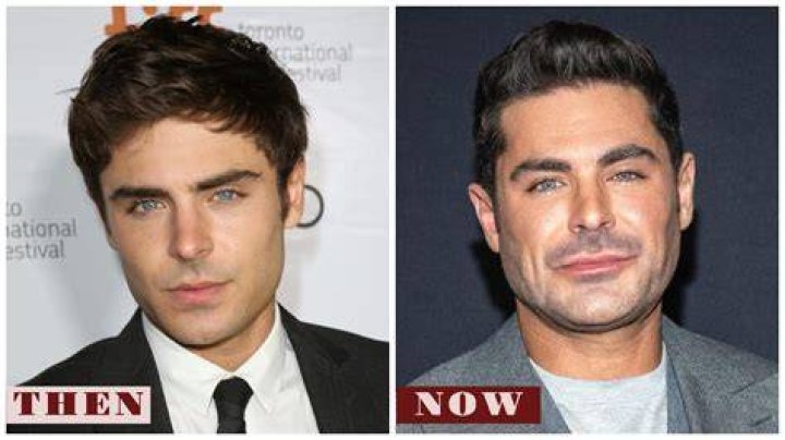 Zac Efron's new look triggers plastic surgery rumours: 'What did they do to his face?'
